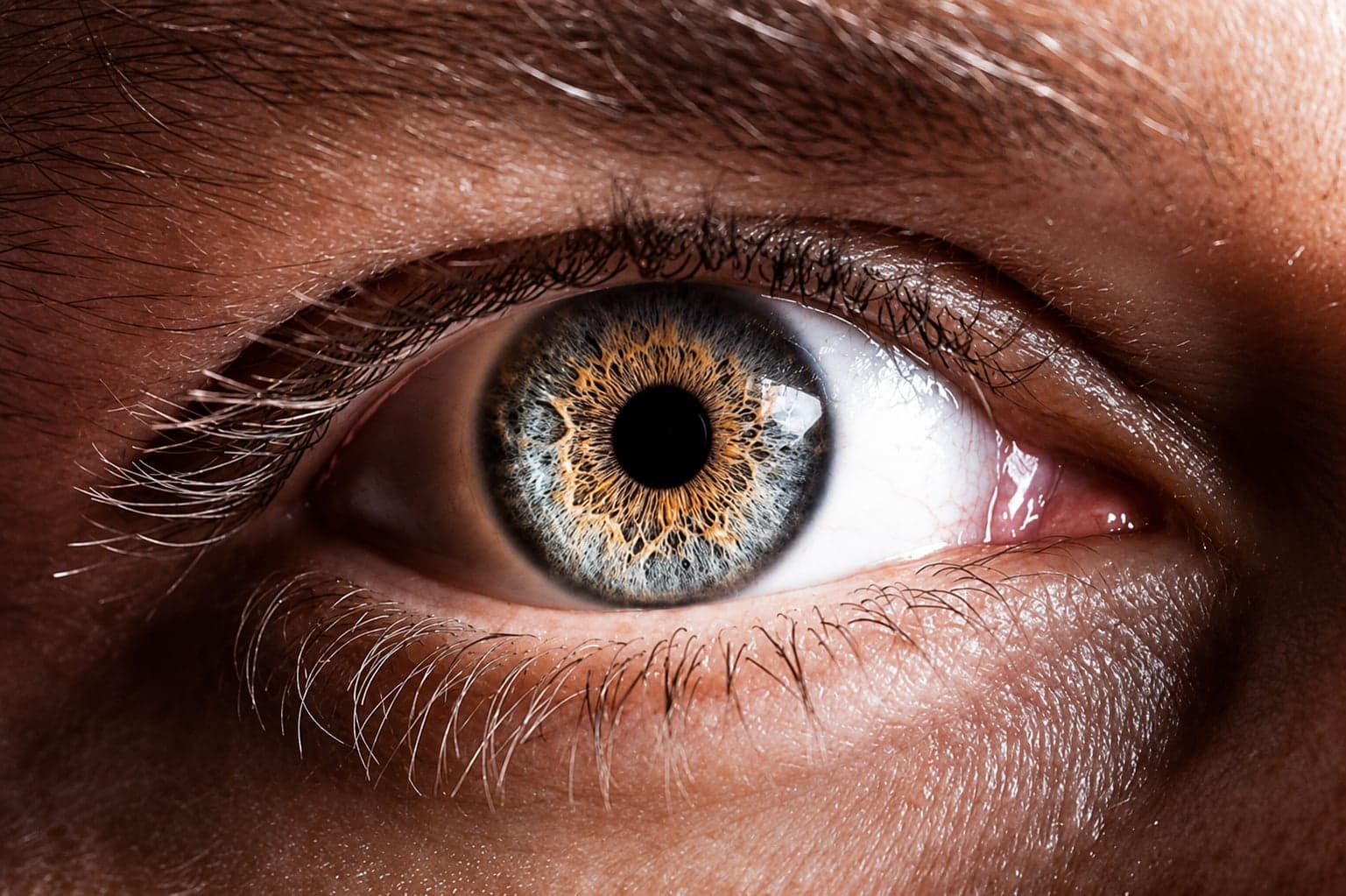 Sample Normal eye photo eye