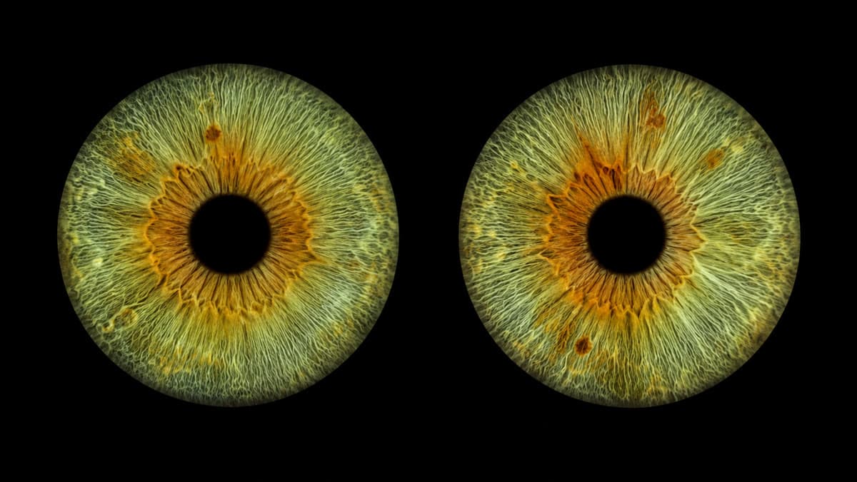 Sample Two-irises comparison eye