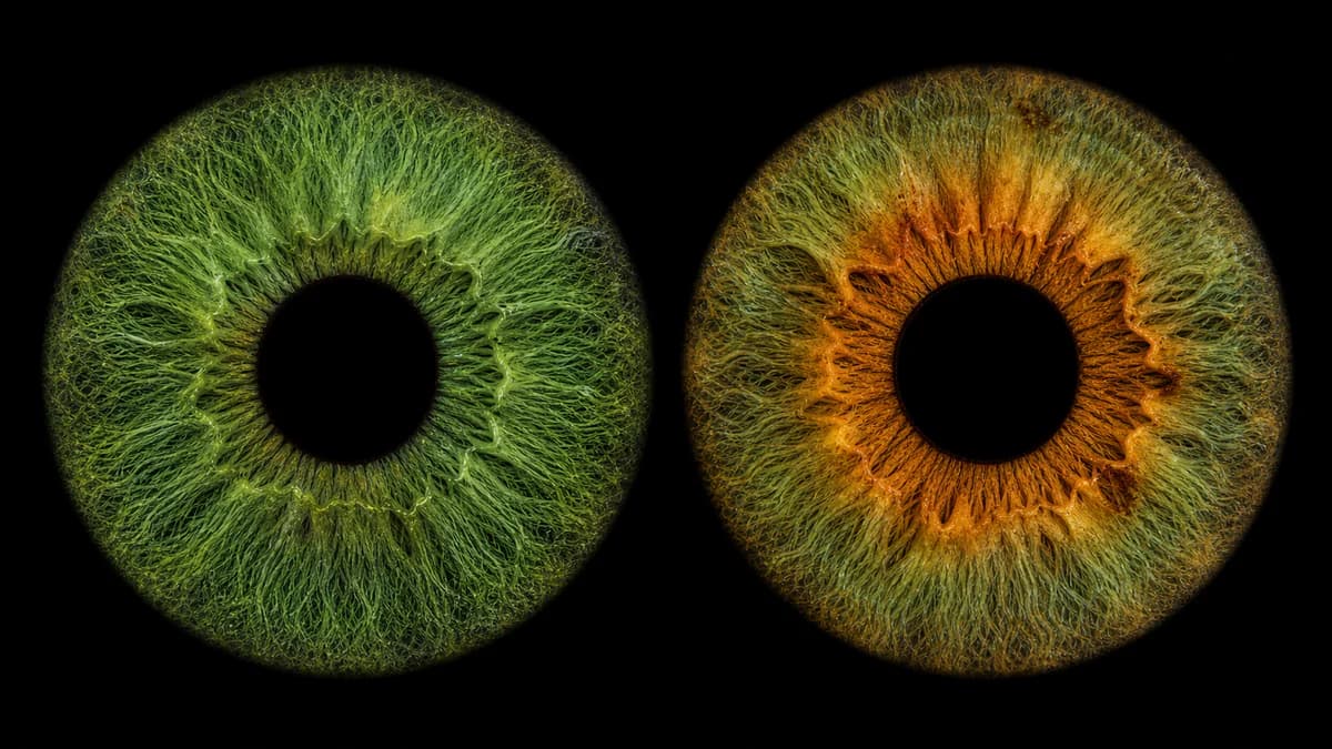 A uniform green iris on the left and a hazel iris with an amber center on the right.