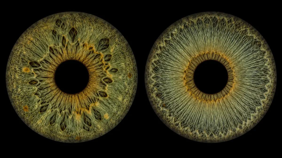 Two similarly colored irises with visibly different crypts, fibers and furrows