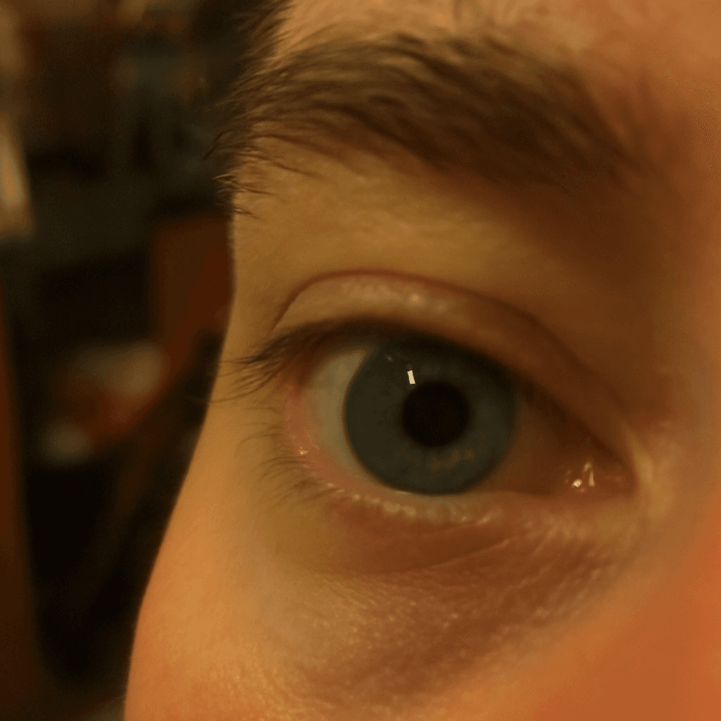 Needs work: a dim, soft-focus eye photo taken from too far away